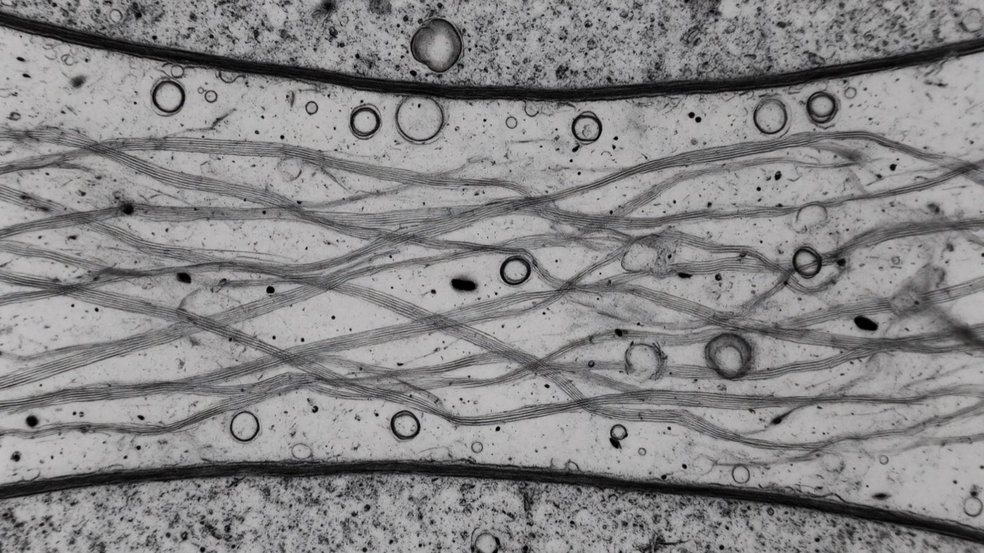 Vista modelada de microscopía electrónica: un espacio estrecho entre dos superficies celulares, atravesado por haces de fibras de colágeno, con vesículas dispersas entre ellos a una fracción de su grosor